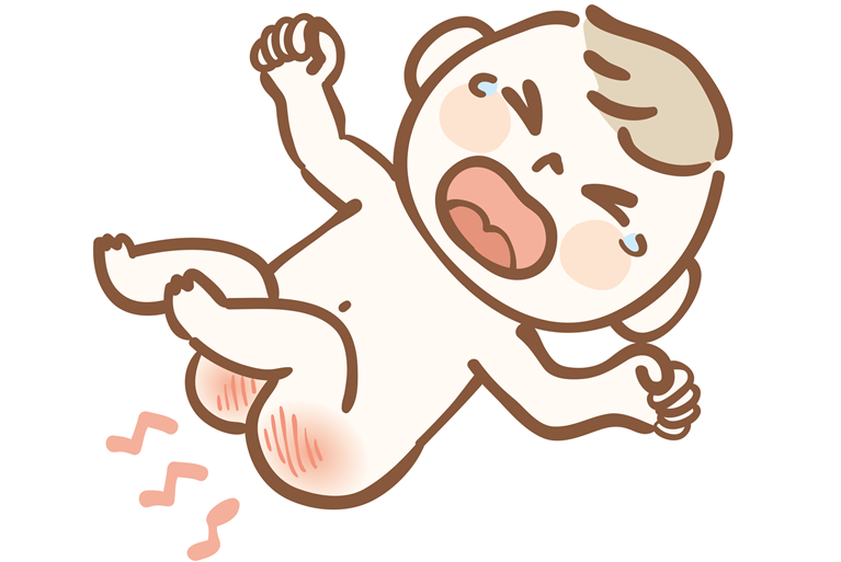 おむつかぶれ