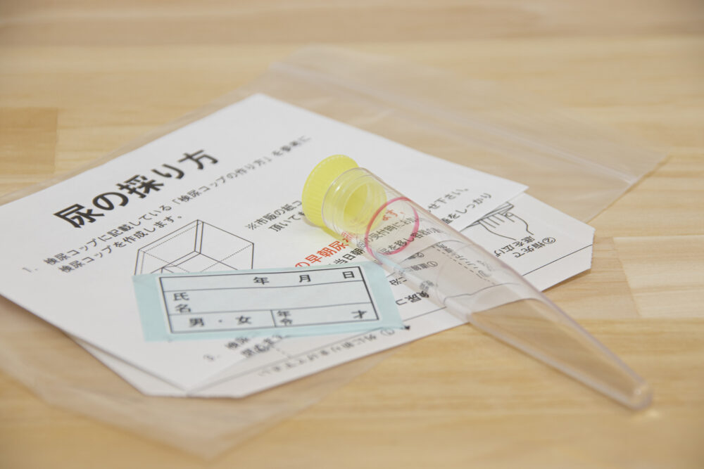 学校や幼稚園の検尿で異常があった場合